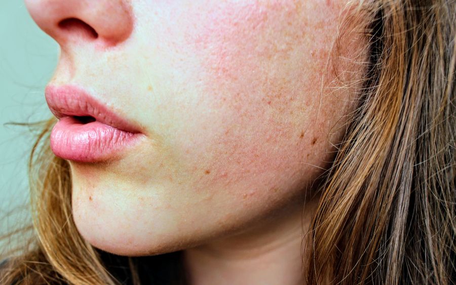 Skin care close-up