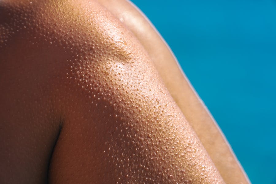 Skin and sun